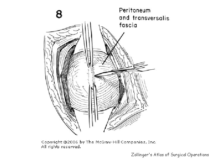 Zollinger's Atlas of Surgical Operations 