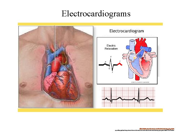 Electrocardiograms http: //www. mercksource. com/pp/us/cns_hl_adam. jspz. Qzpgz. Ezz. Szppdocsz. Szusz. Szcnsz. Szcontentz. Szadamz. Szimagepagesz.