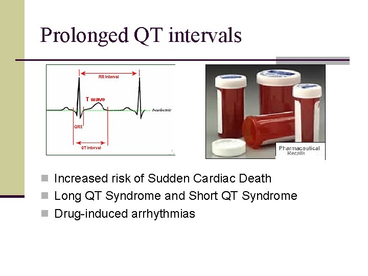 Prolonged QT intervals n Increased risk of Sudden Cardiac Death n Long QT Syndrome