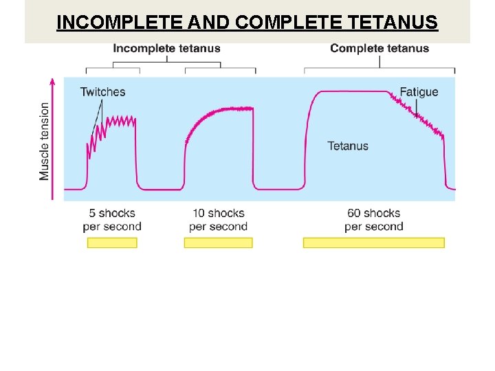 INCOMPLETE AND COMPLETE TETANUS 