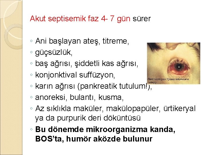 Akut septisemik faz 4 - 7 gün sürer ◦ Ani başlayan ateş, titreme, ◦