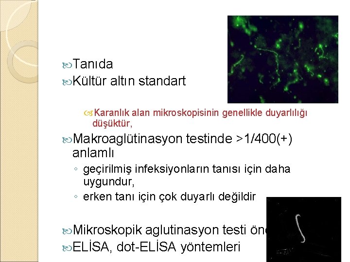  Tanıda Kültür altın standart Karanlık alan mikroskopisinin genellikle duyarlılığı düşüktür, Makroaglütinasyon anlamlı testinde