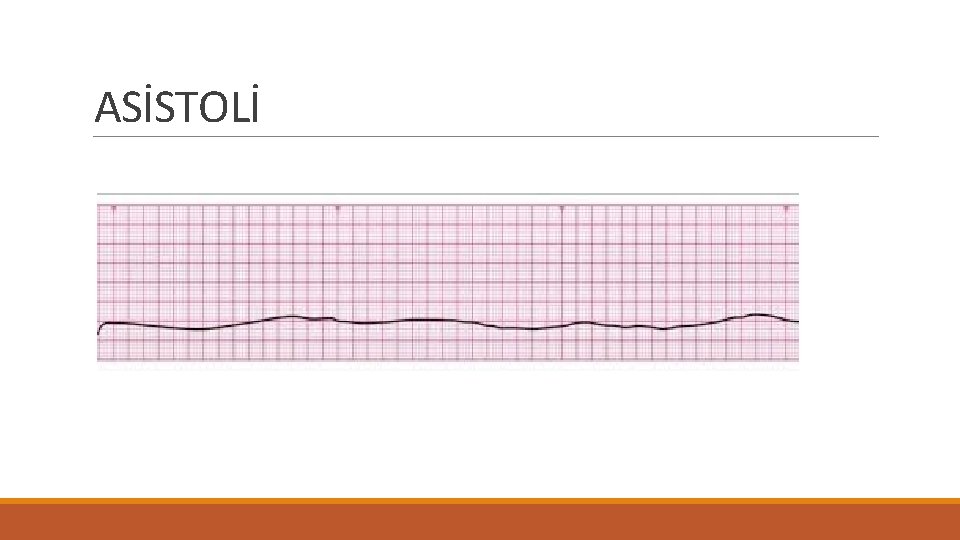 ASİSTOLİ 