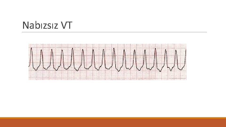 Nabızsız VT 
