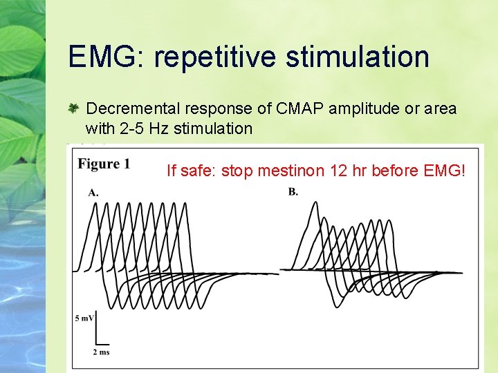 EMG: repetitive stimulation Decremental response of CMAP amplitude or area with 2 -5 Hz