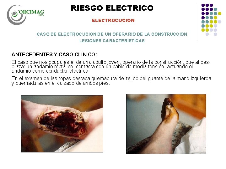 RIESGO ELECTRICO ELECTROCUCION CASO DE ELECTROCUCION DE UN OPERARIO DE LA CONSTRUCCION LESIONES CARACTERISTICAS