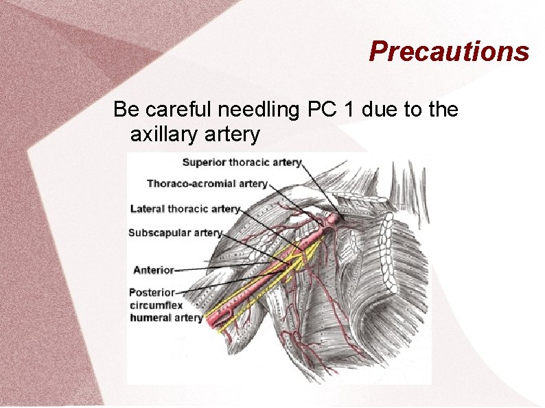 Precautions Be careful needling PC 1 due to the axillary artery 