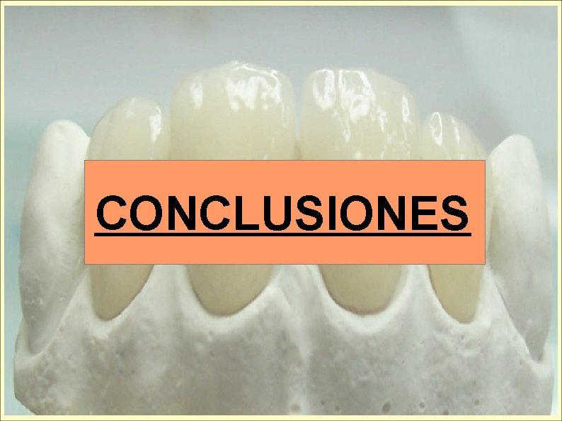 CONCLUSIONES 