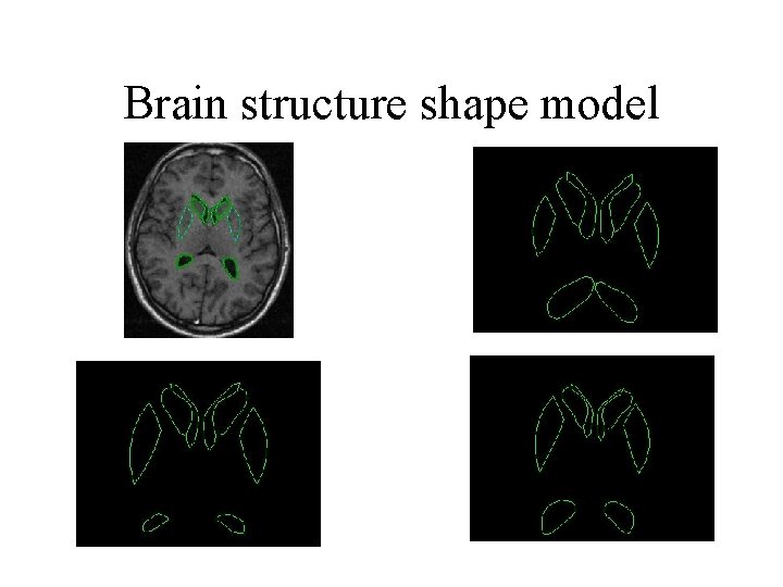 Brain structure shape model 