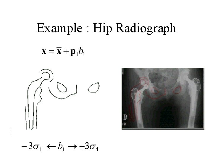 Example : Hip Radiograph 