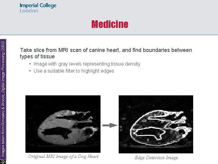 Images taken from Gonzalez & Woods, Digital Image Processing (2002) Medicine Take slice from