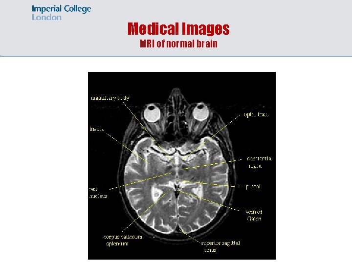 Medical Images MRI of normal brain 