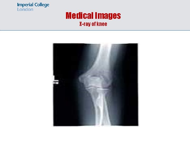 Medical Images X-ray of knee 