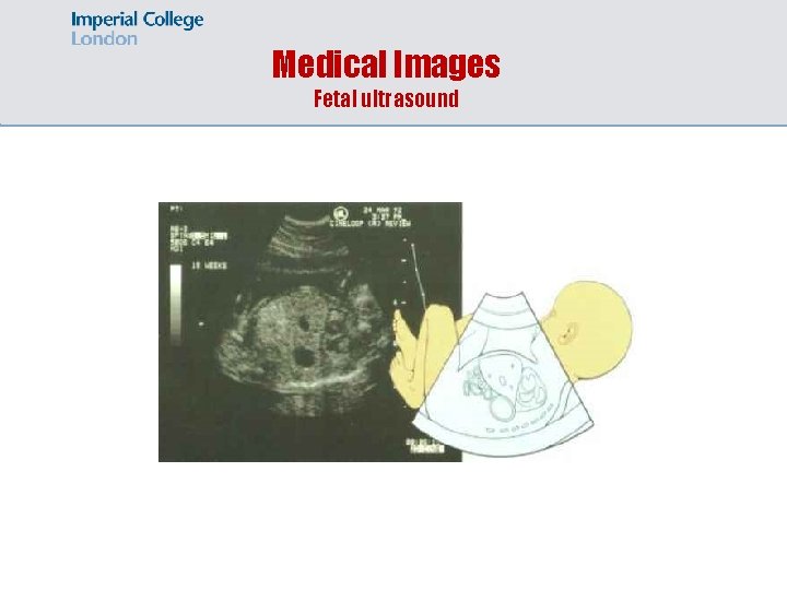 Medical Images Fetal ultrasound 