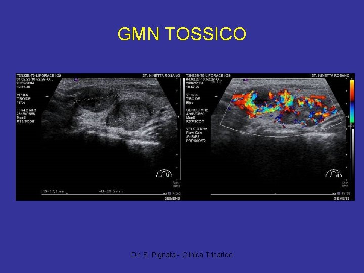 GMN TOSSICO Dr. S. Pignata - Clinica Tricarico 