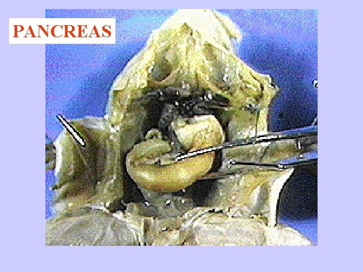 PANCREAS PANCREAS