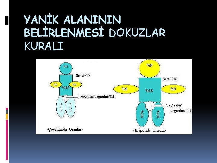 YANİK ALANININ BELİRLENMESİ DOKUZLAR KURALI YANİK ALANININ BELİRLENMESİ DOKUZLAR KURALI