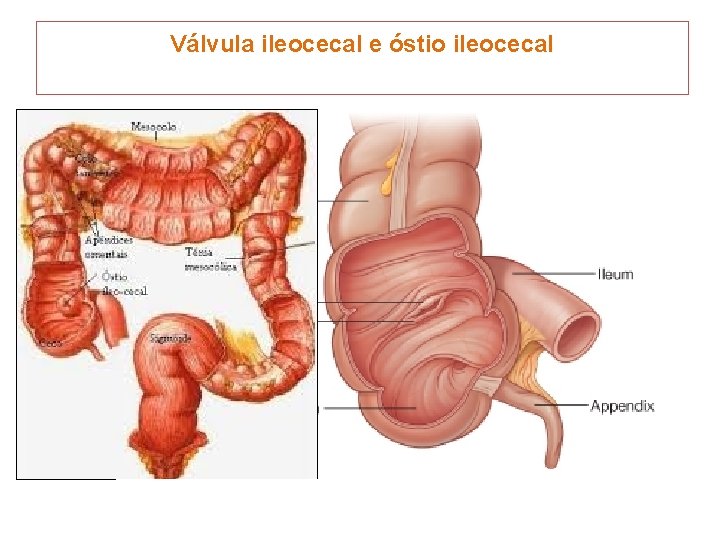 Válvula ileocecal e óstio ileocecal 