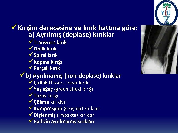 üKırığın derecesine ve kırık hattına göre: a) Ayrılmış (deplase) kırıklar üTransvers kırık üOblik kırık