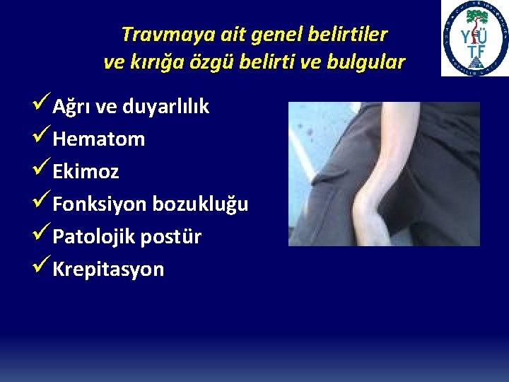 Travmaya ait genel belirtiler ve kırığa özgü belirti ve bulgular üAğrı ve duyarlılık üHematom