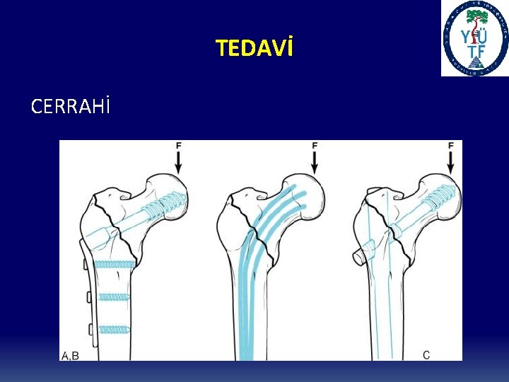 TEDAVİ CERRAHİ 