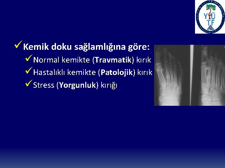 üKemik doku sağlamlığına göre: üNormal kemikte (Travmatik) kırık üHastalıklı kemikte (Patolojik) kırık üStress (Yorgunluk)