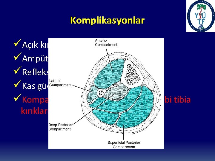 Komplikasyonlar üAçık kırıklar (Yumuşak doku kaybı) üAmpütasyon (Tip IIIC %21 -85) üRefleks sempatik distrofi