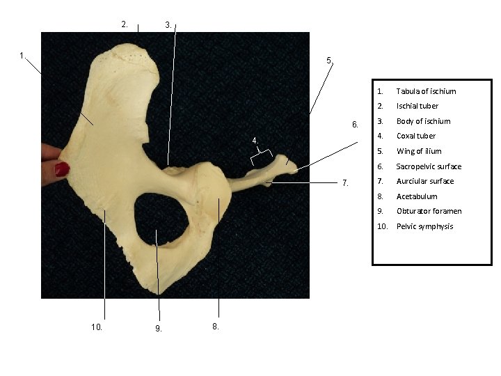 2. 3. 1. 5. 6. 4. 7. 1. Tabula of ischium 2. Ischial tuber