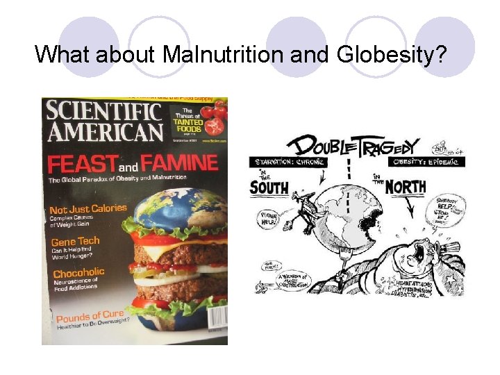 What about Malnutrition and Globesity? 