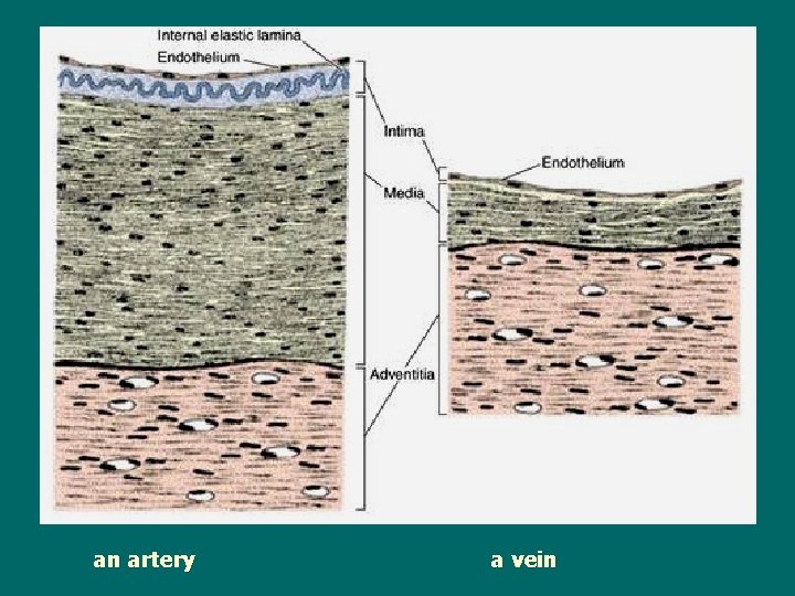 an artery a vein 