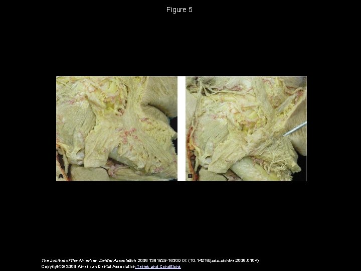 Figure 5 The Journal of the American Dental Association 2008 1391625 -1630 DOI: (10.