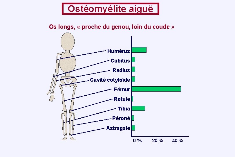 Ostéomyélite aiguë Os longs, « proche du genou, loin du coude » Humérus Cubitus