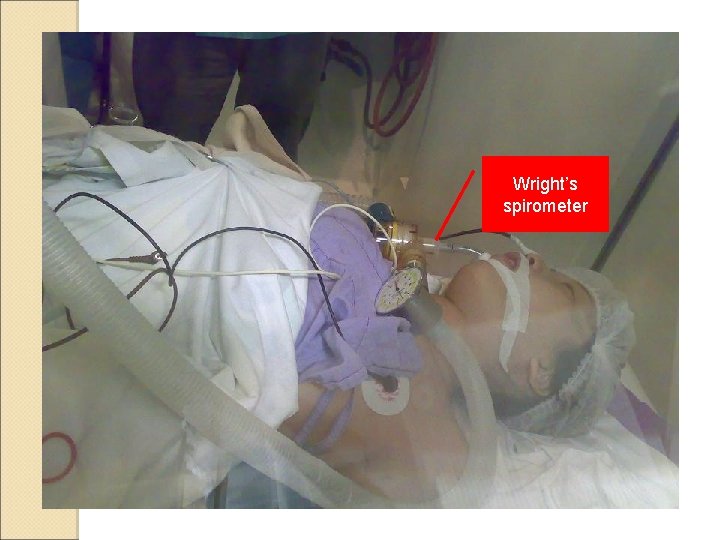 Wright’s spirometer 
