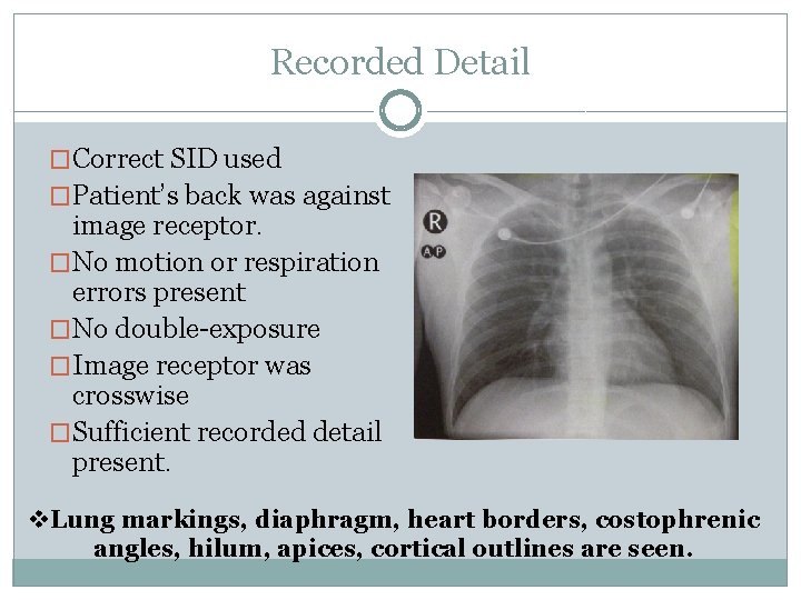 Recorded Detail �Correct SID used �Patient’s back was against image receptor. �No motion or