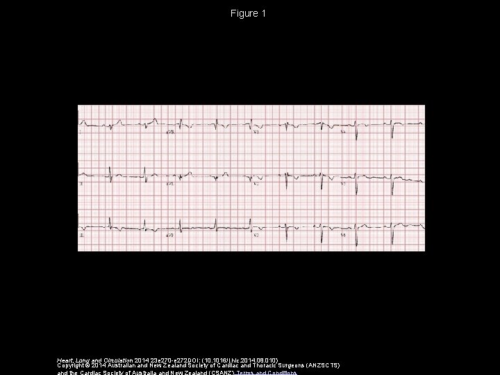 Figure 1 Heart, Lung and Circulation 2014 23 e 270 -e 272 DOI: (10.