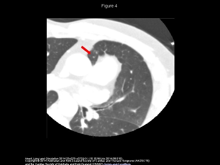 Figure 4 Heart, Lung and Circulation 2014 23 e 270 -e 272 DOI: (10.