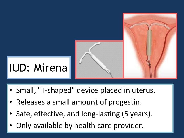 IUD: Mirena • • Small, "T-shaped" device placed in uterus. Releases a small amount