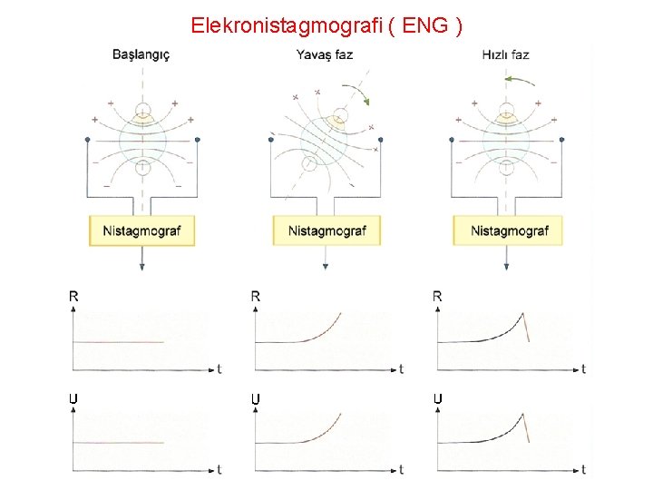 Elekronistagmografi ( ENG ) 