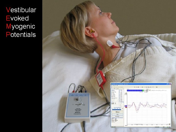 Vestibular Evoked Myogenic Potentials 