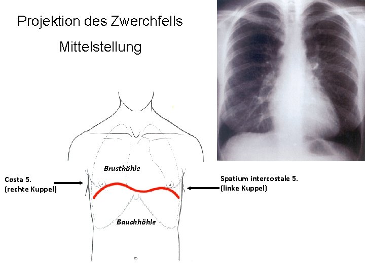 Projektion des Zwerchfells Mittelstellung Brusthöhle Spatium intercostale 5. (linke Kuppel) Costa 5. (rechte Kuppel)