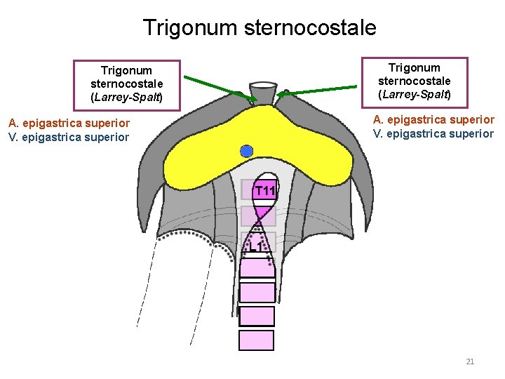 Trigonum sternocostale (Larrey-Spalt) A. epigastrica superior V. epigastrica superior 21 