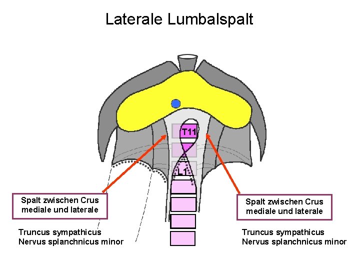 Laterale Lumbalspalt Spalt zwischen Crus mediale und laterale Truncus sympathicus Nervus splanchnicus minor 