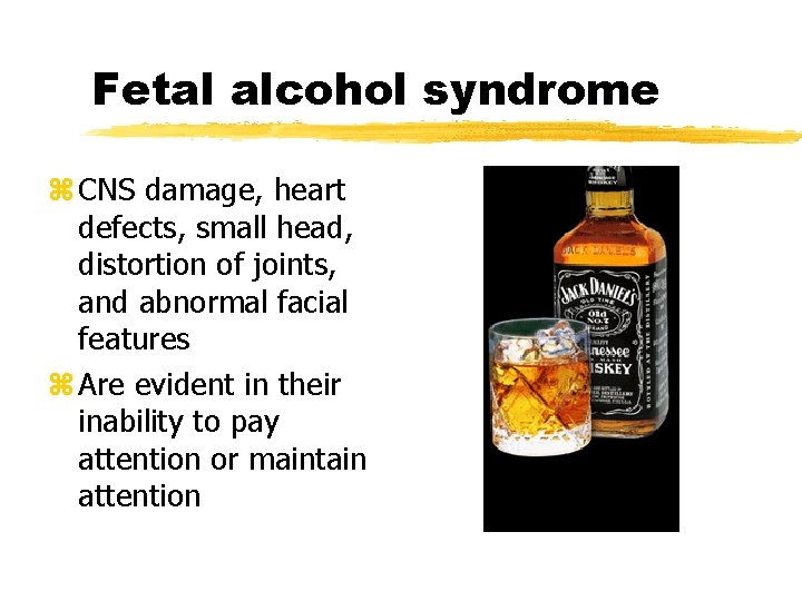 Fetal alcohol syndrome z CNS damage, heart defects, small head, distortion of joints, and