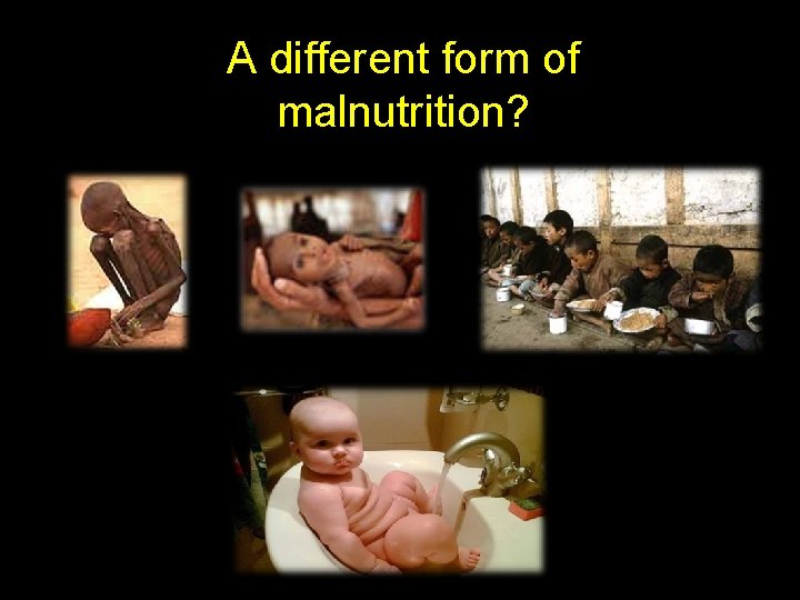A different form of malnutrition? 