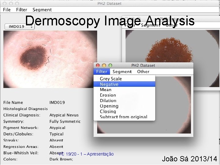 Dermoscopy Image Analysis VC 19/20 - 1 – Apresentação João Sá 2013/14 