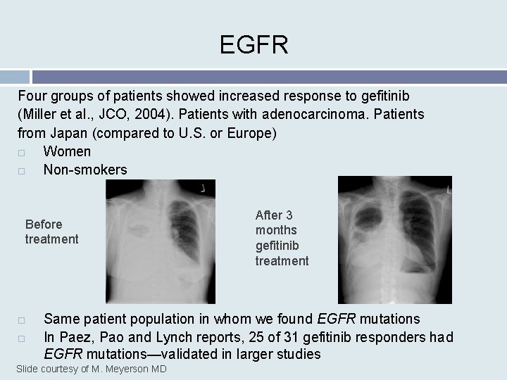 EGFR Four groups of patients showed increased response to gefitinib (Miller et al. ,