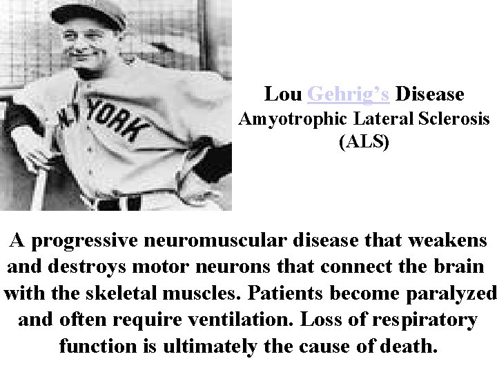 Lou Gehrig’s Disease Amyotrophic Lateral Sclerosis (ALS) A progressive neuromuscular disease that weakens and