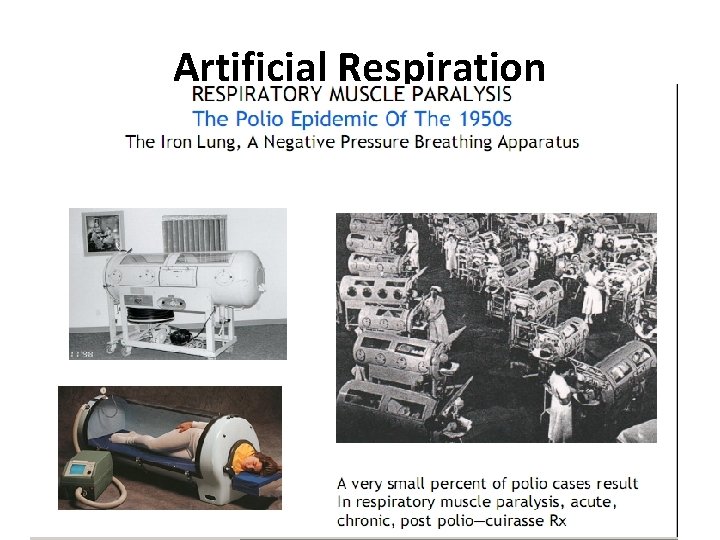 Artificial Respiration 