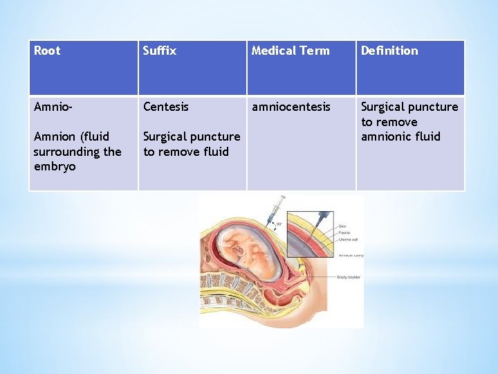 Root Suffix Medical Term Definition Amnio- Centesis amniocentesis Amnion (fluid surrounding the embryo Surgical