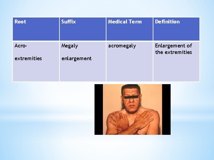 Root Suffix Medical Term Definition Acro- Megaly acromegaly Enlargement of the extremities enlargement 